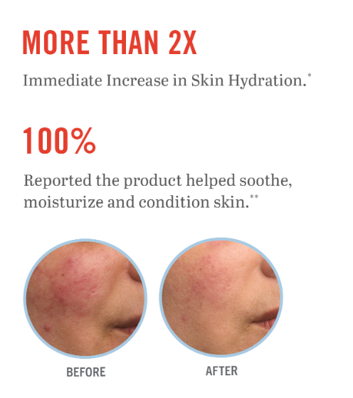 First Aid Beauty Ultra Repair® Cream Intense Hydration JUMBO